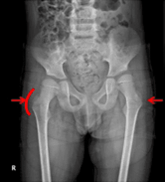 x-ray image