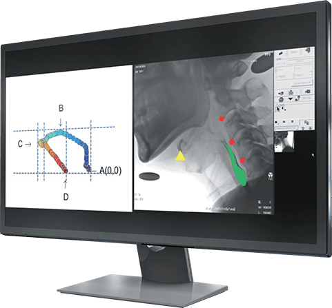 RS-STIM image